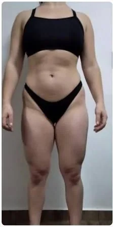 Antes